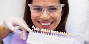 تفاوت لمینت سرامیکی و کامپوزیتی در کرج